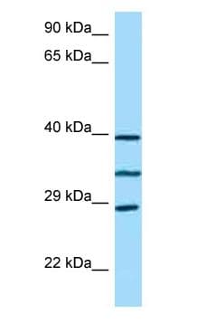 Polyclonal Rabbit anti-Human RP9 Antibody (C-Terminus, WB)