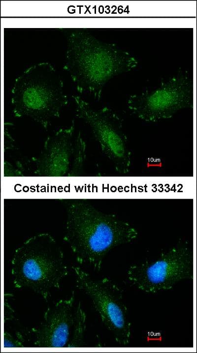 Polyclonal Rabbit anti-Human CAPN5 / Calpain 5 Antibody (aa1-381, WB)