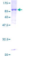 Human TBX22 Protein (Recombinant GST)