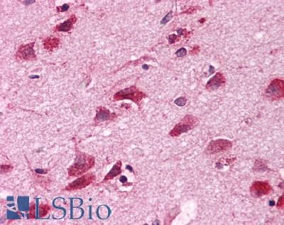 PathPlus™ ADORA1 / Adenosine A1 Receptor Antibody (Cytoplasmic Domain)