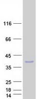 Human ABHD17AP1 Protein (Recombinant Myc-DDK (Flag))