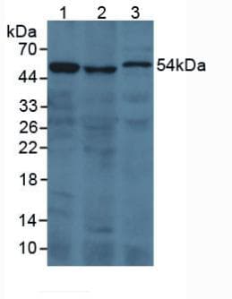 F2 / Prothrombin / Thrombin Antibody (Biotin)