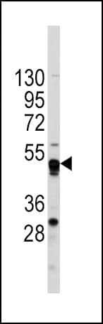 GATA4 Antibody (aa298-328)
