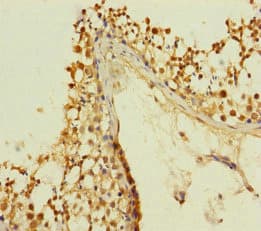 KIZ / PLK1S1 Antibody