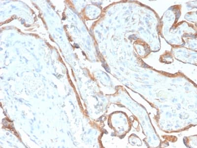 EGFR Antibody (clone GFR/2968R, Azide-free, Carrier-free)