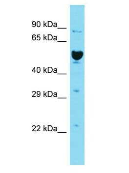 ILDR2 Antibody (aa381-430)
