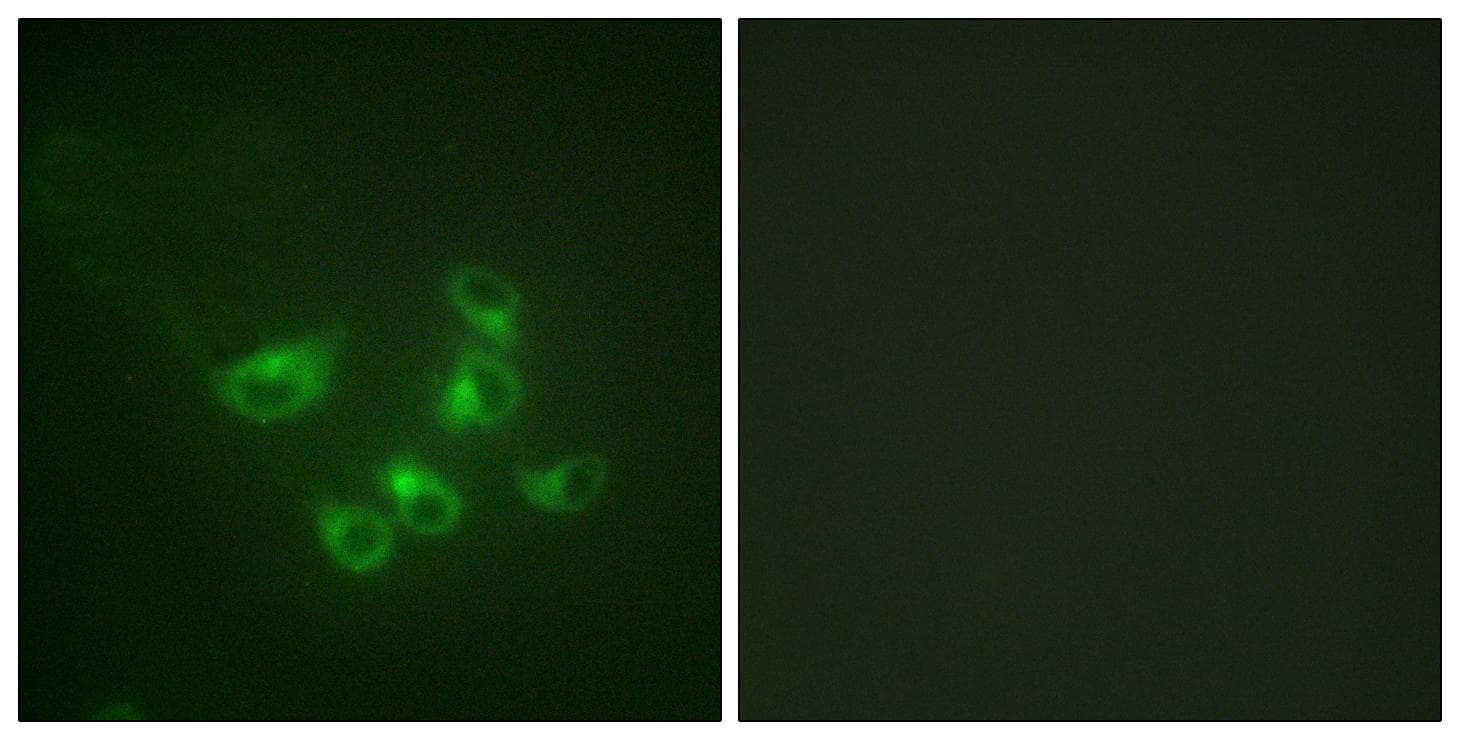Polyclonal Rabbit anti-Human TPH1 / Tryptophan Hydroxylase Antibody (p58, IHC, IF, WB)