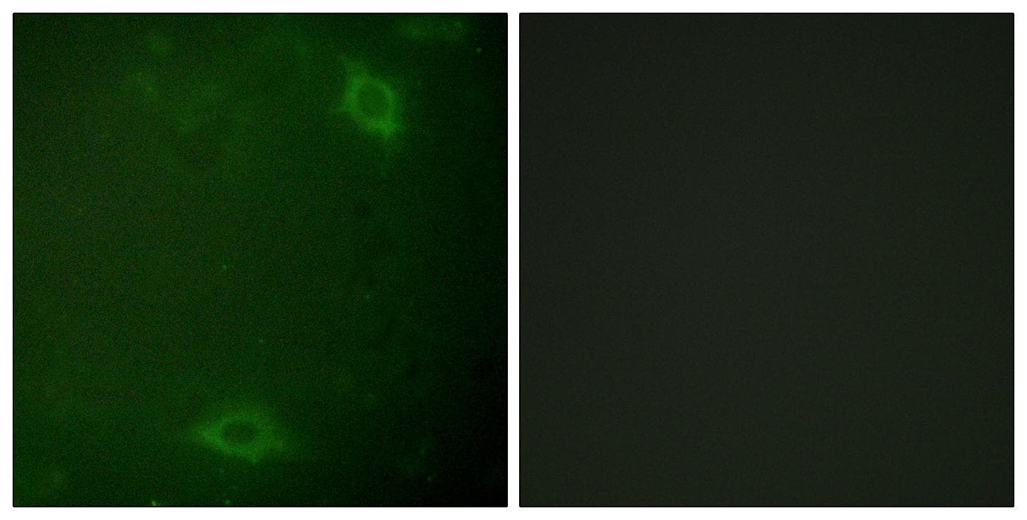 IRAK1 / IRAK Antibody (phospho-Thr387)