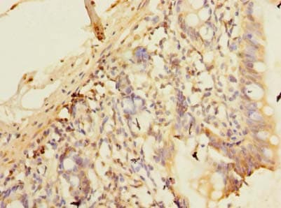 PLEKHS1 / C10orf81 Antibody