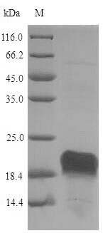 Pig HSP90AA1 / Hsp90 Alpha A1 Protein (Recombinant 6His, N-terminus)