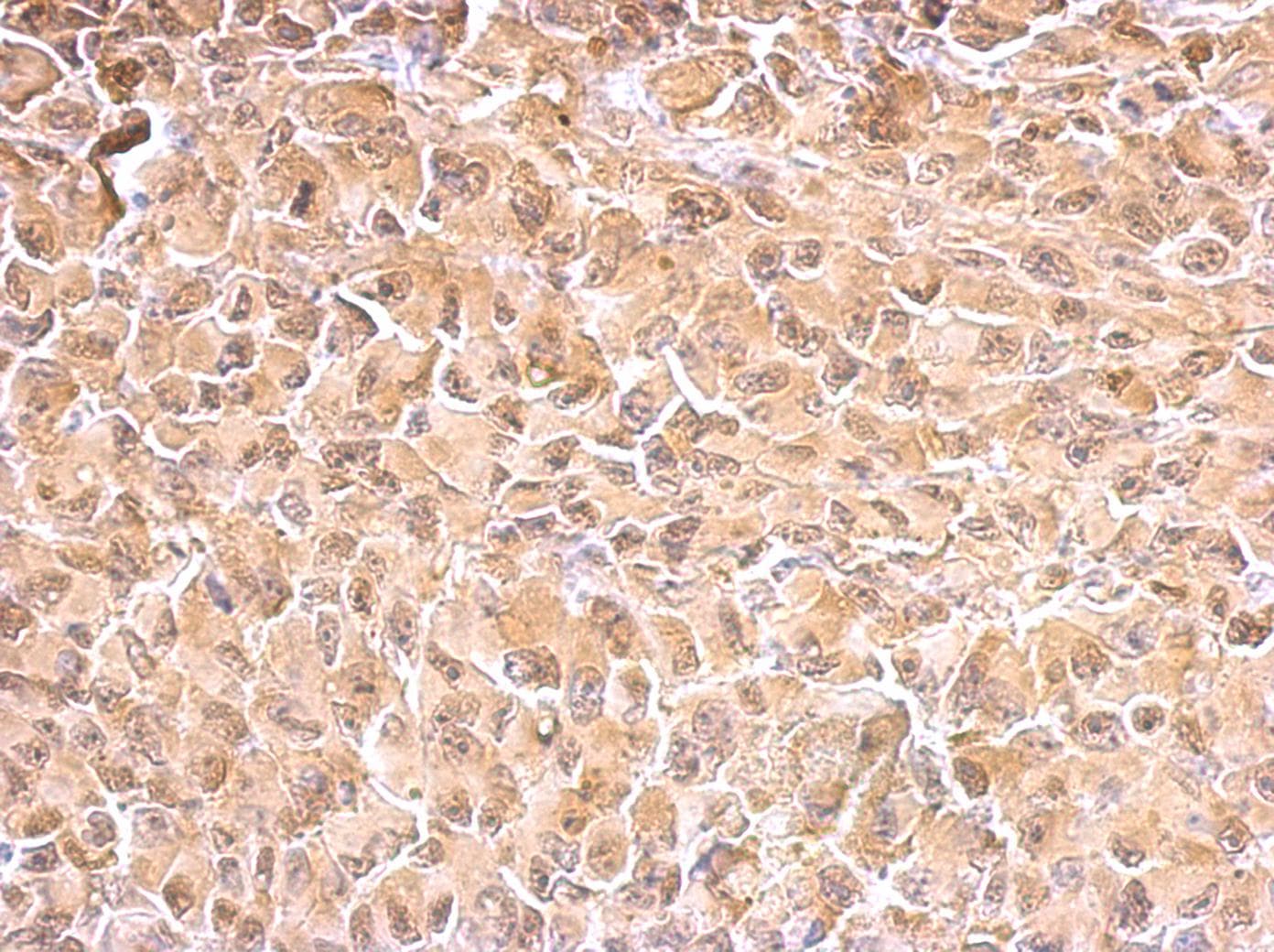 HSP70 / Heat Shock Protein 70 Antibody (aa308-569)