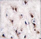 Polyclonal Rabbit anti-Human NR4A2 / NURR1 Antibody (aa13-42, IHC, IF, WB)