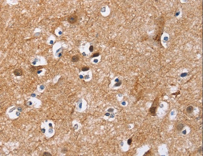 Polyclonal Rabbit anti-Human MAD1L1 / MAD1 Antibody (IHC, WB)