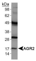 AGR2 Antibody (N-Terminus)
