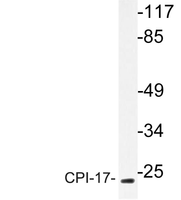 PPP1R14A / CPI-17 Antibody (Lys32)