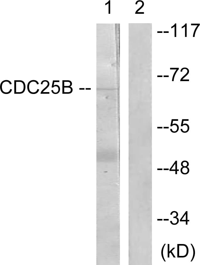 CDC25B Antibody (aa319-368)