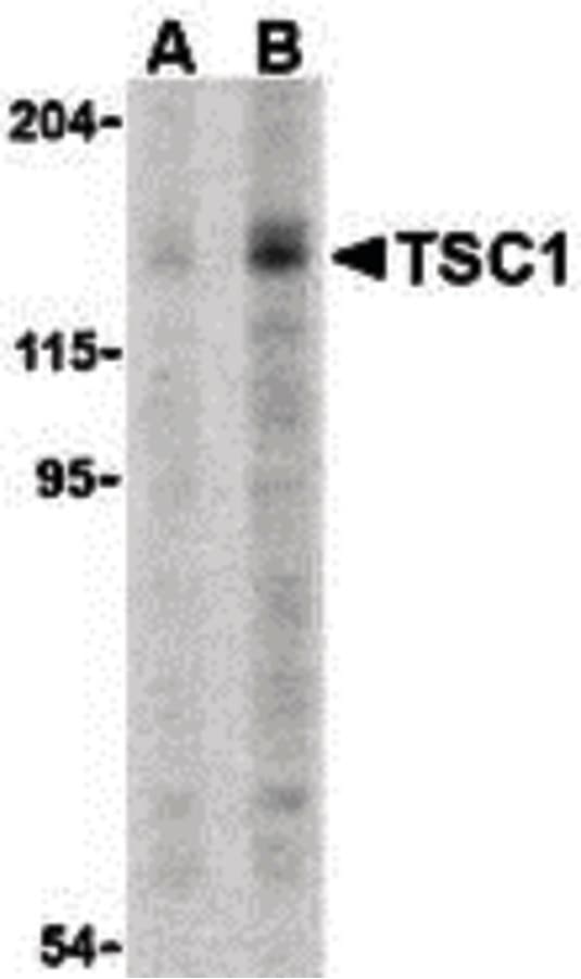 IHC-plus™ Hamartin / TSC1 Antibody