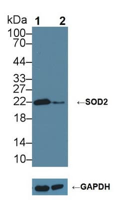 SOD2 / Mn SOD Antibody (aa25-222)