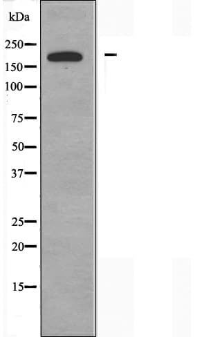 Polyclonal Rabbit anti-Human ARFGEF2 / BIG2 Antibody (IF, WB)