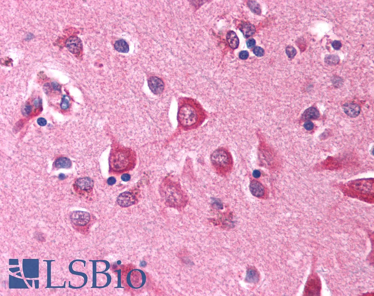 IHC-plus™ Polyclonal Rabbit anti-Human RNF34 Antibody (IHC, IF, WB)