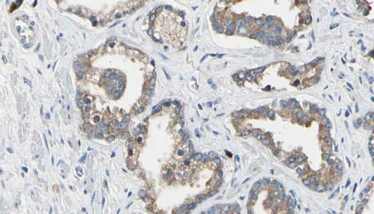 ITGAV/Integrin Alpha V/CD51 Antibody