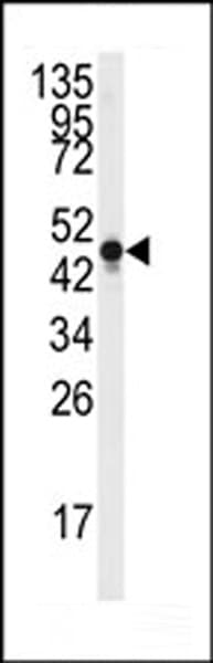 Polyclonal Rabbit anti-Human ENO2 / NSE Antibody (Tyr236, IHC, WB)