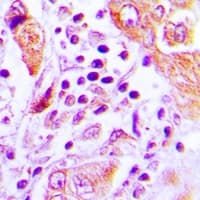 Polyclonal Rabbit anti-Human GFM2 Antibody (IHC, IF, WB)