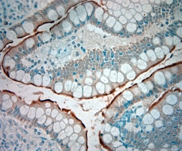 SLC5A8 / AIT Antibody (aa560-610)