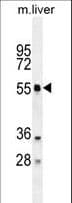 Polyclonal Rabbit anti-Human ATG4D Antibody (aa42-71, IHC, IF, WB)