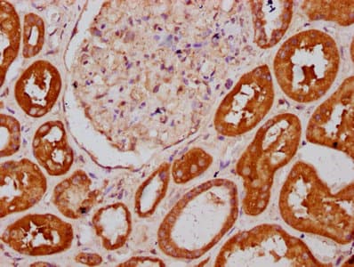 Polyclonal Rabbit anti-Human PLS1 / Fimbrin Antibody (IHC, IF, WB)