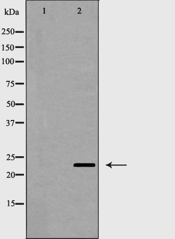 CD83 Antibody