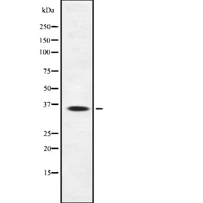 SIRT4 / Sirtuin 4 Antibody