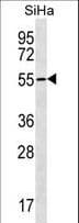 Polyclonal Rabbit anti-Human RNF150 Antibody (aa60-87, WB)