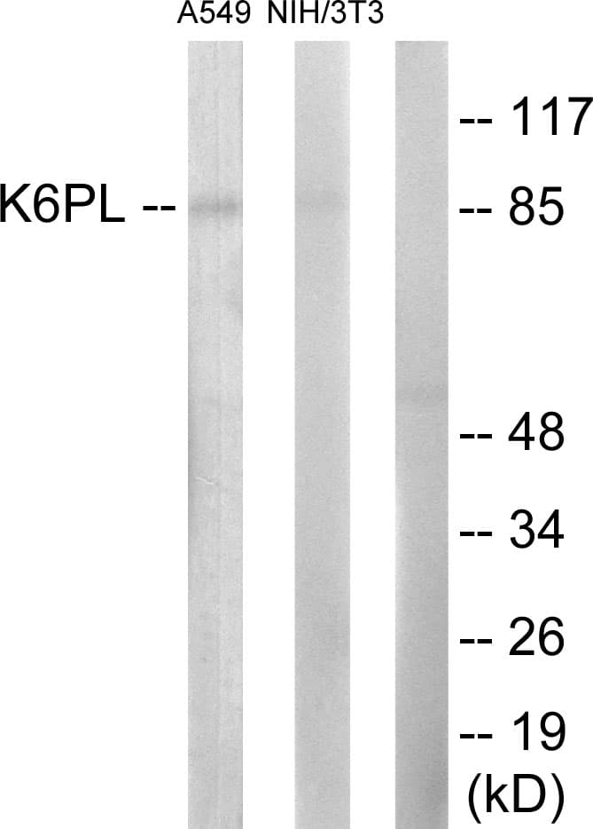 PFKL Antibody (aa691-740)