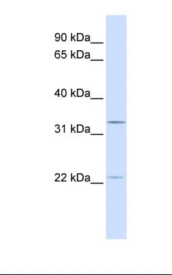 BRI3BP Antibody (C-Terminus, Biotin)