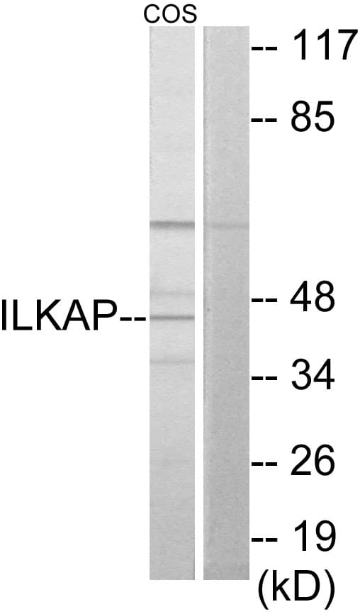 ILKAP Antibody (aa41-90)