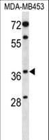 LMPB1 / PAQR8 Antibody (aa326-354)