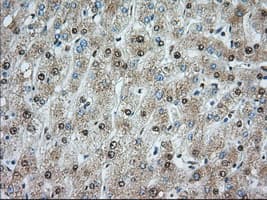 Monoclonal Mouse anti-Human ACSBG1 / hsBG Antibody (clone OTI1D8, IHC, IF, WB)