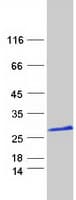 Human FAM153C Protein (Recombinant Myc-DDK (Flag))