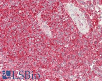 IHC-plus™ USP6NL Antibody (aa350-400)