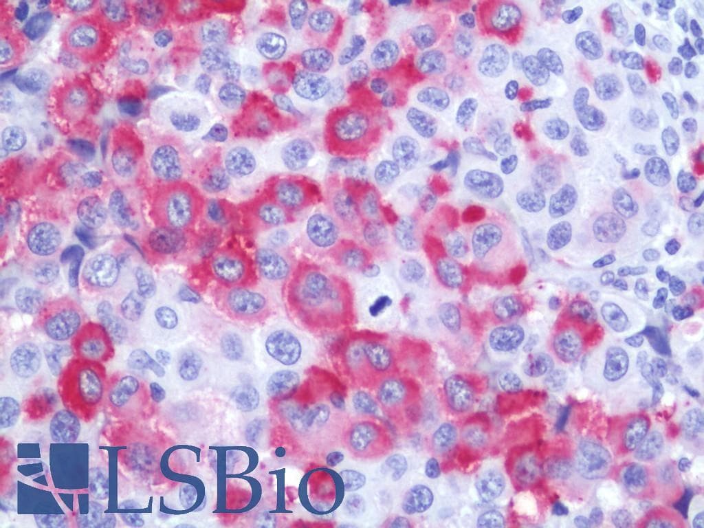 IHC-plus™ WNT10A Antibody (Internal)