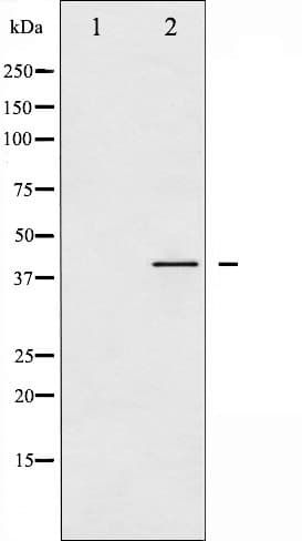 VASP Antibody (phospho-Ser157)