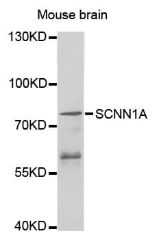 SCNN1A / ENaC Alpha Antibody