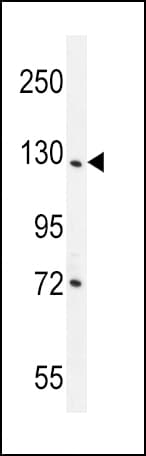 DDX60L Antibody (aa1200-1228)