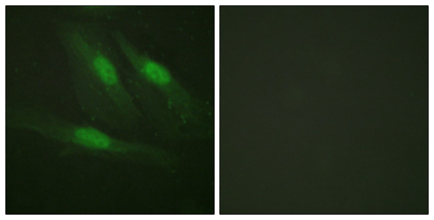 CTNNB1 / Beta Catenin Antibody (aa620-669)