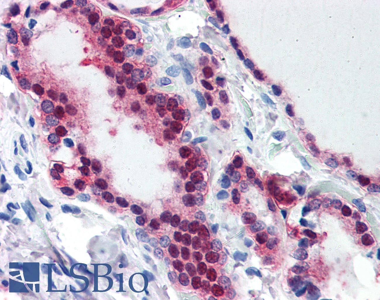 IHC-plus™ TIA-1 Antibody (aa189-199)