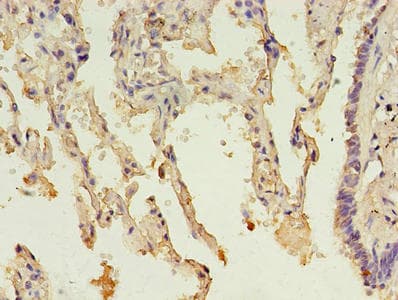 HsT19268 / MTHFS Antibody (aa2-203)
