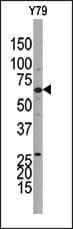 GUCY1B3 Antibody (aa589-619)