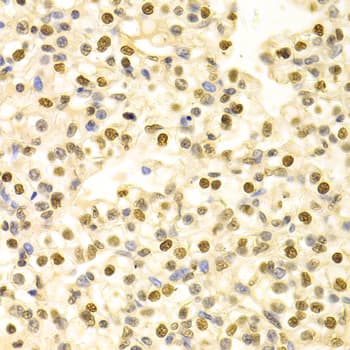 HDGF Antibody