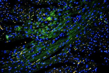 CAV3 / Caveolin 3 Antibody